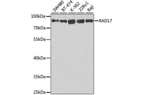 RAD17 anticorps  (AA 391-670)