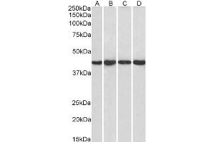 Western Blotting (WB) image for anti-Protein Phosphatase 1, Regulatory Subunit 8 (PPP1R8) antibody (ABIN5930543) (PPP1R8 anticorps)