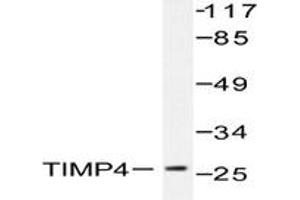 Image no. 1 for anti-TIMP Metallopeptidase Inhibitor 4 (TIMP4) antibody (ABIN271963) (TIMP4 anticorps)
