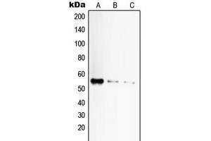 Western blot analysis of CD120a expression in HeLa (A), mouse liver (B), rat liver (C) whole cell lysates.