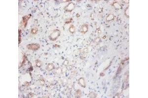 Immunohistochemistry of paraffin-embedded human kidney tissue using ABIN7147023 at dilution of 1:100