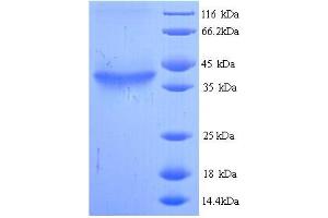 SDS-PAGE (SDS) image for Hyaluronan Synthase 2 (HAS2) (AA 67-374), (Cytoplasmic Domain), (Cytosolic) protein (His tag) (ABIN5713496)