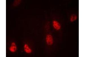 Immunofluorescent analysis of RPL36 staining in MDAMB435 cells. (RPL36 anticorps  (Center))