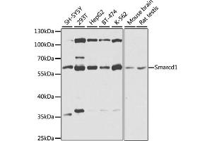 Western blot analysis of extracts of various cell lines, using Smarcd1 antibody (ABIN6132669, ABIN6137420, ABIN6137421 and ABIN6225284) at 1:1000 dilution. (SMARCD1 anticorps  (AA 1-120))