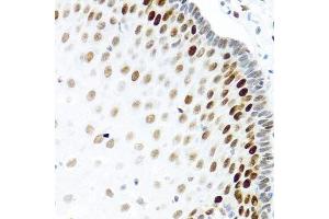 Immunohistochemistry of paraffin-embedded human esophagus using KHDRBS2 antibody. (KHDRBS2 anticorps  (C-Term))