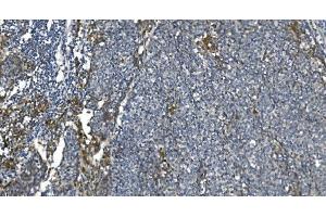 IHC analysis of eRF1/ETF1 using anti-eRF1/ETF1 antibody (ABIN7602625). (ETF1 anticorps  (AA 9-342))