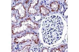 NOX4 antibody immunohistochemistry analysis in formalin fixed and paraffin embedded human kidney tissue. (NADPH Oxidase 4 anticorps  (AA 124-153))