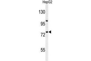 Western blot analysis of ZNF202 Antibody (Center) in HepG2 cell line lysates (35 µg/lane). (ZNF202 anticorps  (Middle Region))