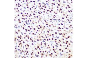 Immunohistochemistry of paraffin-embedded rat ovary using SP3 Rabbit pAb (ABIN6130701, ABIN6148314, ABIN6148315 and ABIN6216542) at dilution of 1:100 (40x lens).