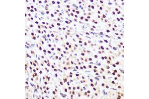 Immunohistochemistry of paraffin-embedded rat ovary using SP3 Rabbit pAb (ABIN6130701, ABIN6148314, ABIN6148315 and ABIN6216542) at dilution of 1:100 (40x lens). (Sp3 anticorps  (AA 240-350))