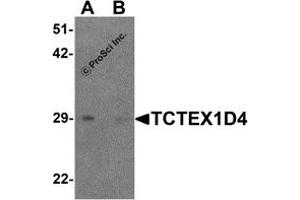 Western Blotting (WB) image for anti-Tctex1 Domain Containing 4 (TCTEX1D4) (N-Term) antibody (ABIN1587950) (TCTEX1D4 anticorps  (N-Term))