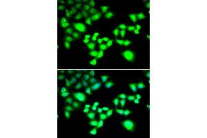 Immunofluorescence analysis of MCF-7 cells using RAD1 antibody (ABIN5995531). (RAD1 anticorps)