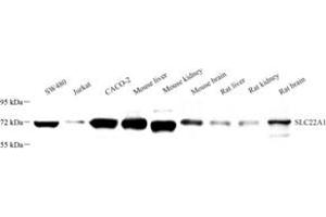 Western blot analysis of SLC22A1 (ABIN7075663) at dilution of 1: 1000 (SLC22A1 anticorps)