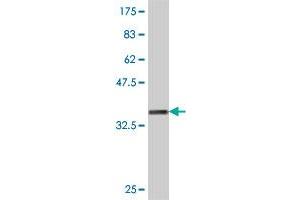 Western Blot detection against Immunogen (36. (PPM1M anticorps  (AA 102-192))