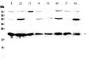 Western blot analysis of HP1 gamma using anti-HP1 gamma antibody .