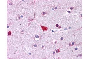 Immunohistochemistry (IHC) image for anti-Fatty Acid Binding Protein 4, Adipocyte (FABP4) (Middle Region) antibody (ABIN2778217)