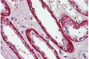 anti-Eukaryotic Translation Initiation Factor 3 Subunit E (EIF3E) (AA 36-85) antibody