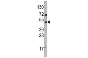 Western blot analysis of VEGFD antibody and 293 lysate