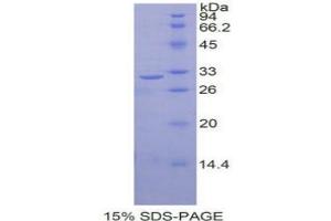SDS-PAGE analysis of Human RELB Protein.