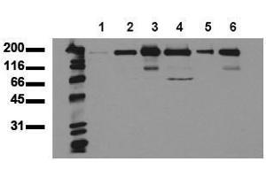 Western Blotting (WB) image for anti-Receptor Tyrosine-Protein Kinase ErbB-3 (ERBB3) (AA 1250-1270), (Cytoplasmic Domain) antibody (ABIN126794) (ERBB3 anticorps  (Cytoplasmic Domain))