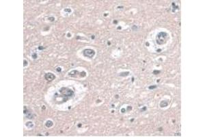 IHC-P analysis of Human Brain Tissue, with DAB staining. (CD34 anticorps  (AA 32-290))