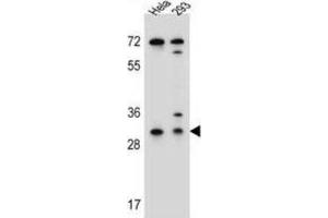 Western Blotting (WB) image for anti-Ephrin B2 (EFNB2) antibody (ABIN2996297) (Ephrin B2 anticorps)