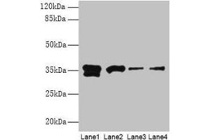 Western blot All lanes: APEX1 antibody at 2 μg/mL Lane 1: Hela whole cell lysate Lane 2: Mouse brain tissue Lane 3: MCF-7 whole cell lysate Lane 4: A431 whole cell lysate Secondary Goat polyclonal to rabbit IgG at 1/15000 dilution Predicted band size: 36 kDa Observed band size: 36 kDa (APEX1 anticorps  (AA 32-318))
