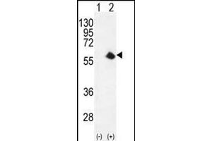 Western blot analysis of CDK8 (arrow) using rabbit polyclonal CDK8 Antibody (Center) (ABIN655911 and ABIN2845310). (CDK8 anticorps  (AA 249-277))