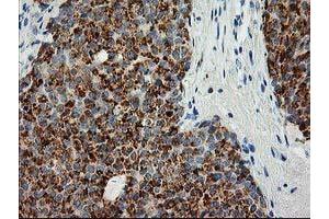 Image no. 9 for anti-Adenylate Kinase 4 (AK4) antibody (ABIN1496524)