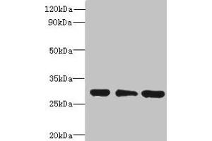 Western blot All lanes: HDHD3 antibody at 1 μg/mL Lane 1: Mouse small intestine tissue Lane 2: HT29 whole cell lysate Lane 3: COLO205 whole cell lysate Secondary Goat polyclonal to rabbit IgG at 1/10000 dilution Predicted band size: 28 kDa Observed band size: 28 kDa (HDHD3 anticorps  (AA 1-251))