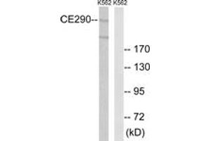 Western blot analysis of extracts from K562 cells, using CEP290 Antibody. (CEP290 anticorps  (AA 771-820))