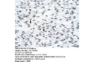 anti-LIM Homeobox 3 (LHX3) (Middle Region) antibody