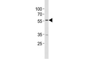 Western blot analysis of lysate from MCF-7 cell line using NAMPT antibody diluted at 1:1000. (NAMPT anticorps  (AA 400-426))