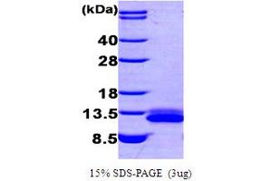 Chemokine (C-X-C Motif) Ligand 12 (CXCL12) (AA 22-93) protein (His tag)