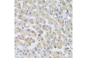 Immunohistochemistry of paraffin-embedded human liver injury using SNAP29 antibody. (SNAP29 anticorps  (AA 1-258))