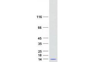 Validation with Western Blot