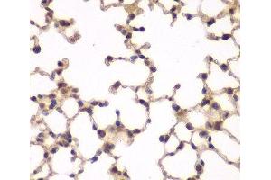 Immunohistochemistry of paraffin-embedded Mouse lung using PIP4K2A Polyclonal Antibody at dilution of 1:100 (40x lens).
