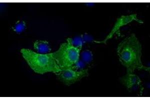 Anti-KIAA1609 mouse monoclonal antibody (ABIN2453202) immunofluorescent staining of COS7 cells transiently transfected by pCMV6-ENTRY KIAA1609 (RC209287). (KIAA1609 anticorps)