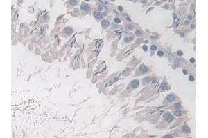 Detection of PDE4B in Rat Testis Tissue using Polyclonal Antibody to Phosphodiesterase 4B, cAMP Specific (PDE4B)