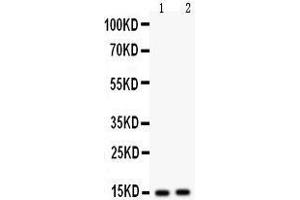 Anti- Fatty Acid Binding Protein 5 antibody, Western blotting All lanes: Anti Fatty Acid Binding Protein 5  at 0.