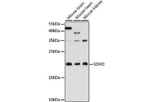 Western blot analysis of extracts of various cell lines, using SDHD antibody (ABIN7270622) at 1:3000 dilution.