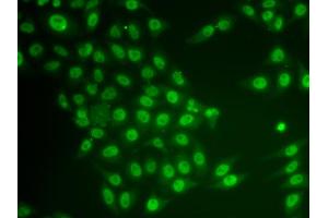 Immunofluorescence analysis of HeLa cells using CRY2 antibody (ABIN6291959).