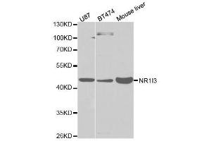 Western blot analysis of extracts of various cell lines, using NR1I3 antibody. (NR1I3 anticorps  (AA 103-352))