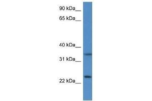 Western Blot showing Cyb5r1 antibody used at a concentration of 1. (CYB5R1 anticorps  (N-Term))