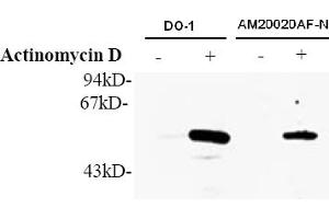 Western Blotting (WB) image for anti-Tumor Protein P53 (TP53) (AA 378-393), (pSer392) antibody (ABIN487475) (p53 anticorps  (pSer392))