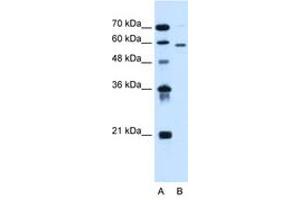Image no. 2 for anti-Asparagine-Linked Glycosylation 11, alpha-1,2-Mannosyltransferase Homolog (Yeast) (ALG11) (AA 392-441) antibody (ABIN6736673) (ALG11 anticorps  (AA 392-441))