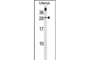 GUCA1C Antibody (C-term) (ABIN1881400 and ABIN2839072) western blot analysis in human Uterus tissue lysates (35 μg/lane). (GUCA1C anticorps  (C-Term))