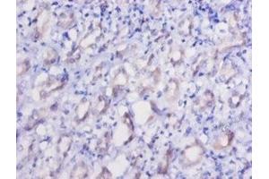 Immunohistochemistry of paraffin-embedded human kidney tissue using ABIN7151548 at dilution of 1:50 (EEF2 anticorps  (AA 2-858))