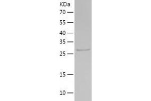 Western Blotting (WB) image for PSME3 (PSME3) (AA 1-267) protein (His-IF2DI Tag) (ABIN7124706)