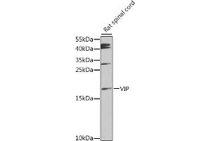 Western blot analysis of extracts of rat spinal cord, using VIP antibody (ABIN6130781, ABIN6150111, ABIN6150112 and ABIN6216193) at 1:1000 dilution. (Vip anticorps  (AA 31-170))